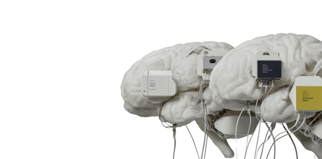 AI in service operations: How we keep 24/7 service teams sharp with Agentic AI, without working overtime AI in service operations: How we keep 24/7 service teams sharp with Agentic AI, without working overtime