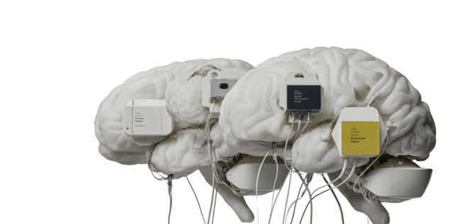 AI in service operations: How we keep 24/7 service teams sharp with Agentic AI, without working overtime AI in service operations: How we keep 24/7 service teams sharp with Agentic AI, without working overtime