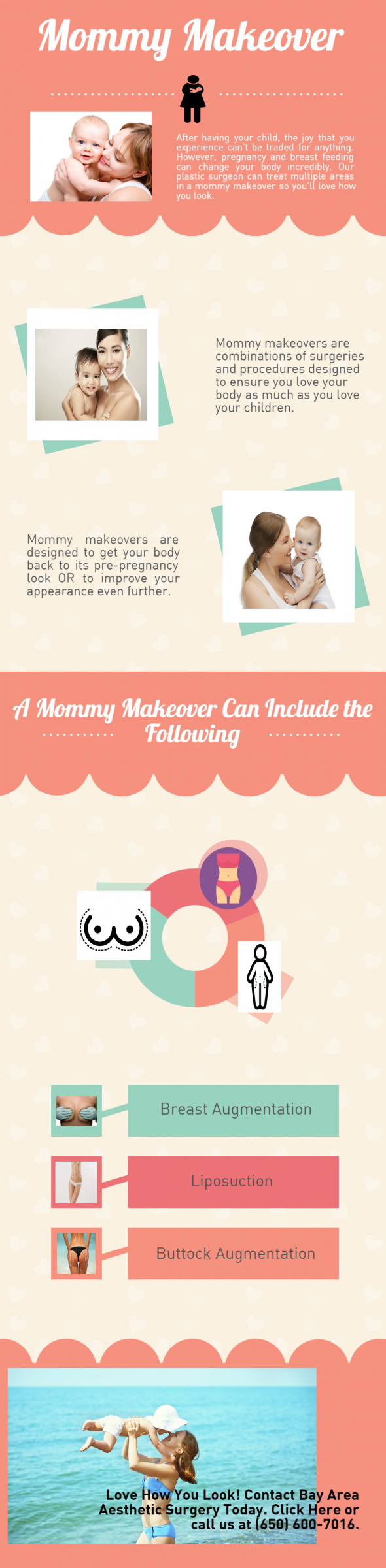 beckjoel-mommy-makeover-05-24-16-mk_1