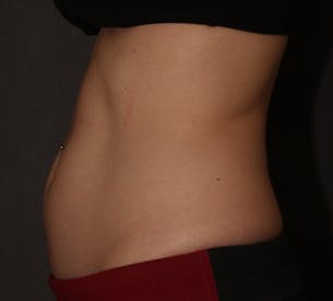procedure