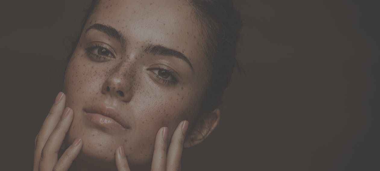 Close up of young woman with beautiful glowing skin with lots of freckles in studio shoot