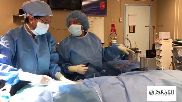 Dr. Parakh in the operating room performing a Fat Transfer/Liposuction treatment