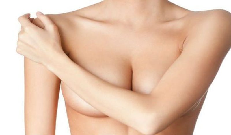 Can A Breast Reduction Ease My Back Pain? - Stephens Plastic Surgery