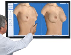 Vectra-3D Procedures