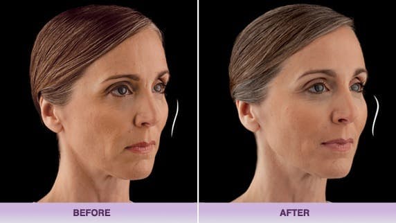 The Press Room - Egrari Plastic Surgery Center