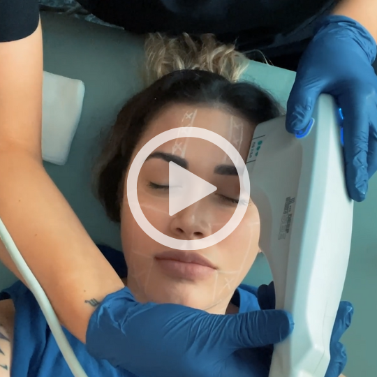 Watch Ultherapy treatment video