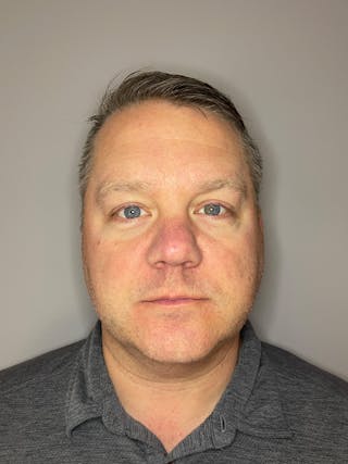 BBL Before & After Gallery - Patient 872466 - Image 2