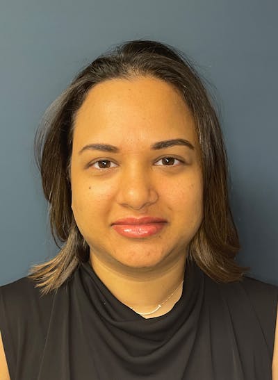 Facial Fillers Before & After Gallery - Patient 344407 - Image 1