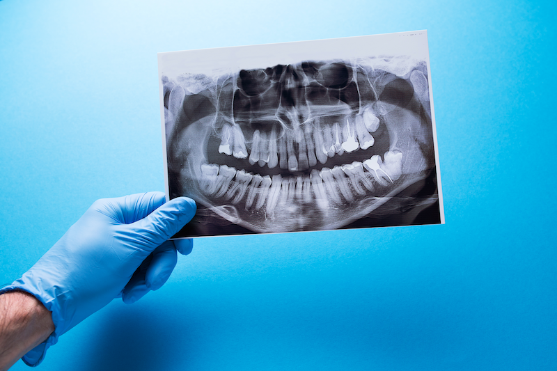 3D počítačová tomografie