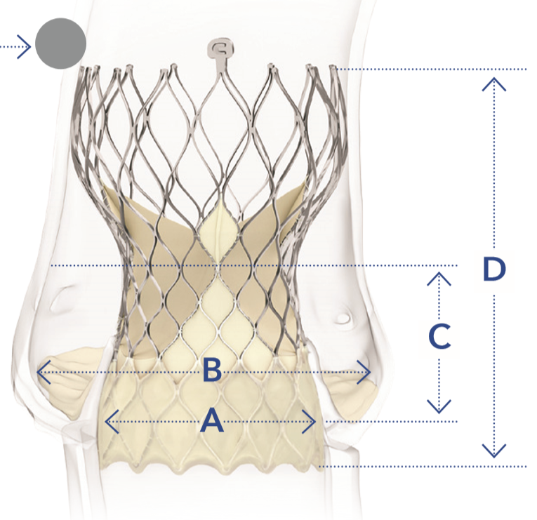 Evolut R Sizes Choix de la taille de prothèse Evolut™ PRO+