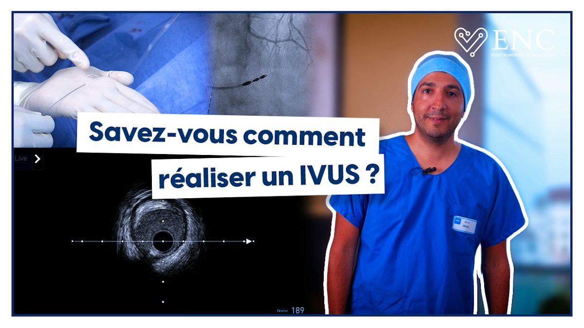 Comment réaliser un IVUS