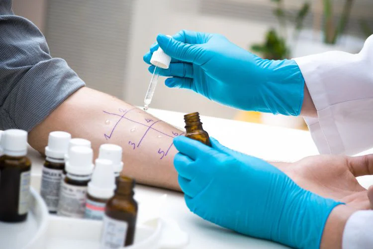 Allergy test on skin