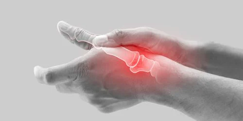 Arthritis in the fingers and joint