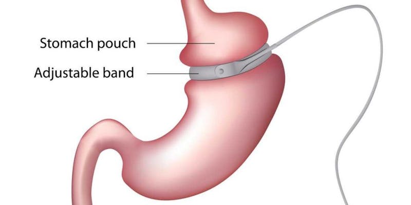 stomach diagram