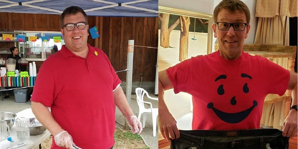 Male patient after weight loss surgery in Tijuana, Mexico at OCC