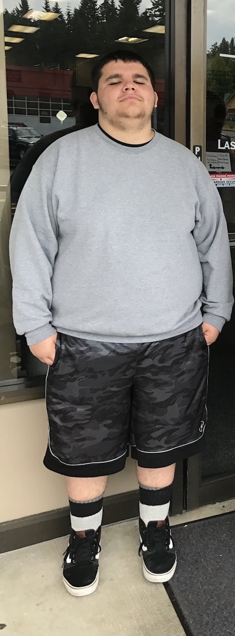 Patients 16-19 Years Old Before & After Gallery - Patient 14494143 - Image 1