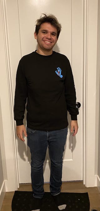 Patients 16-19 Years Old Before & After Gallery - Patient 14494143 - Image 2