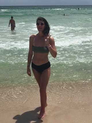 Patients 16-19 Years Old Before & After Gallery - Patient 14494144 - Image 2