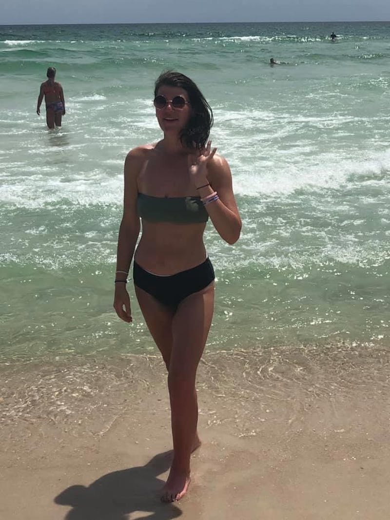 Patients 16-19 Years Old Before & After Gallery - Patient 14494144 - Image 2