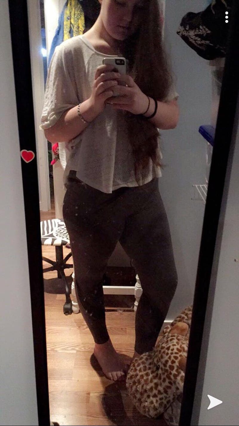 Patients 16-19 Years Old Before & After Gallery - Patient 14494145 - Image 2