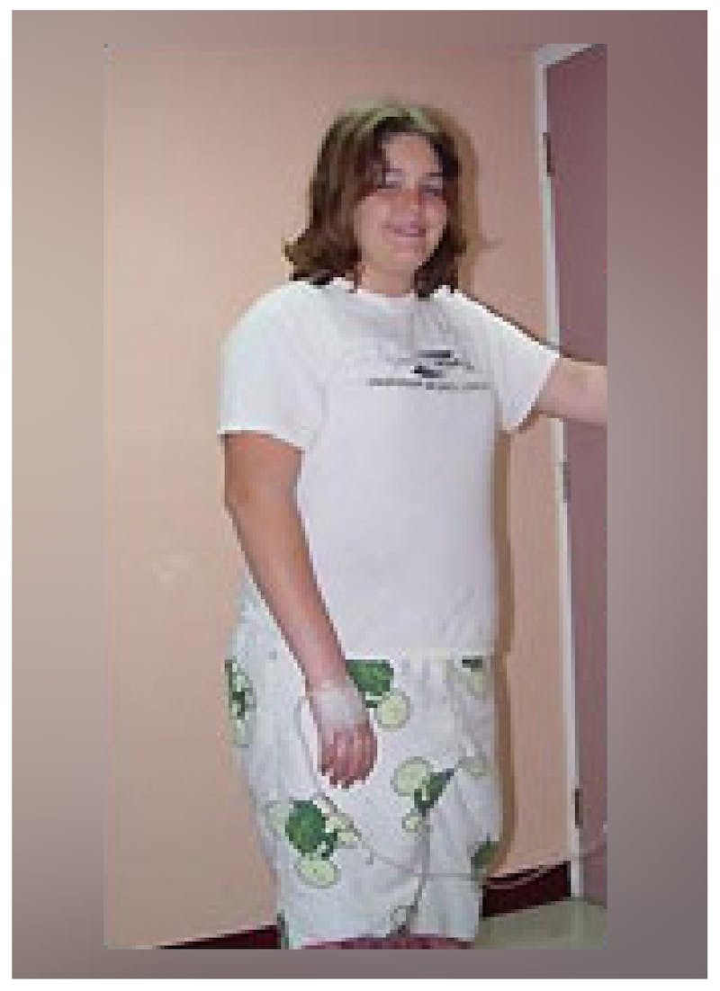 Patients 16-19 Years Old Before & After Gallery - Patient 14494147 - Image 1