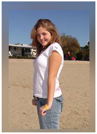 Patients 16-19 Years Old Before & After Gallery - Patient 14494147 - Image 2