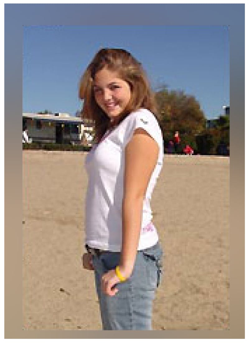 Patients 16-19 Years Old Before & After Gallery - Patient 14494147 - Image 2