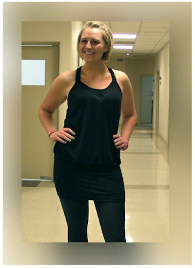 Patients 16-19 Years Old Before & After Gallery - Patient 14494148 - Image 2