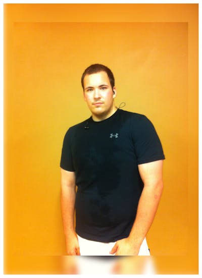 Patients 16-19 Years Old Before & After Gallery - Patient 14494149 - Image 2