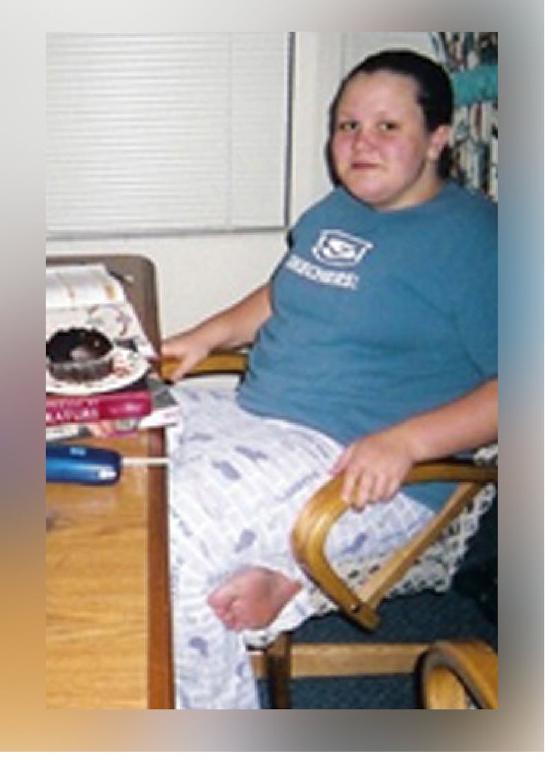 Patients 16-19 Years Old Before & After Gallery - Patient 14494150 - Image 1