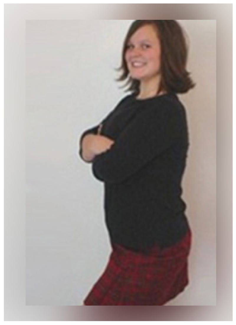 Patients 16-19 Years Old Before & After Gallery - Patient 14494150 - Image 2