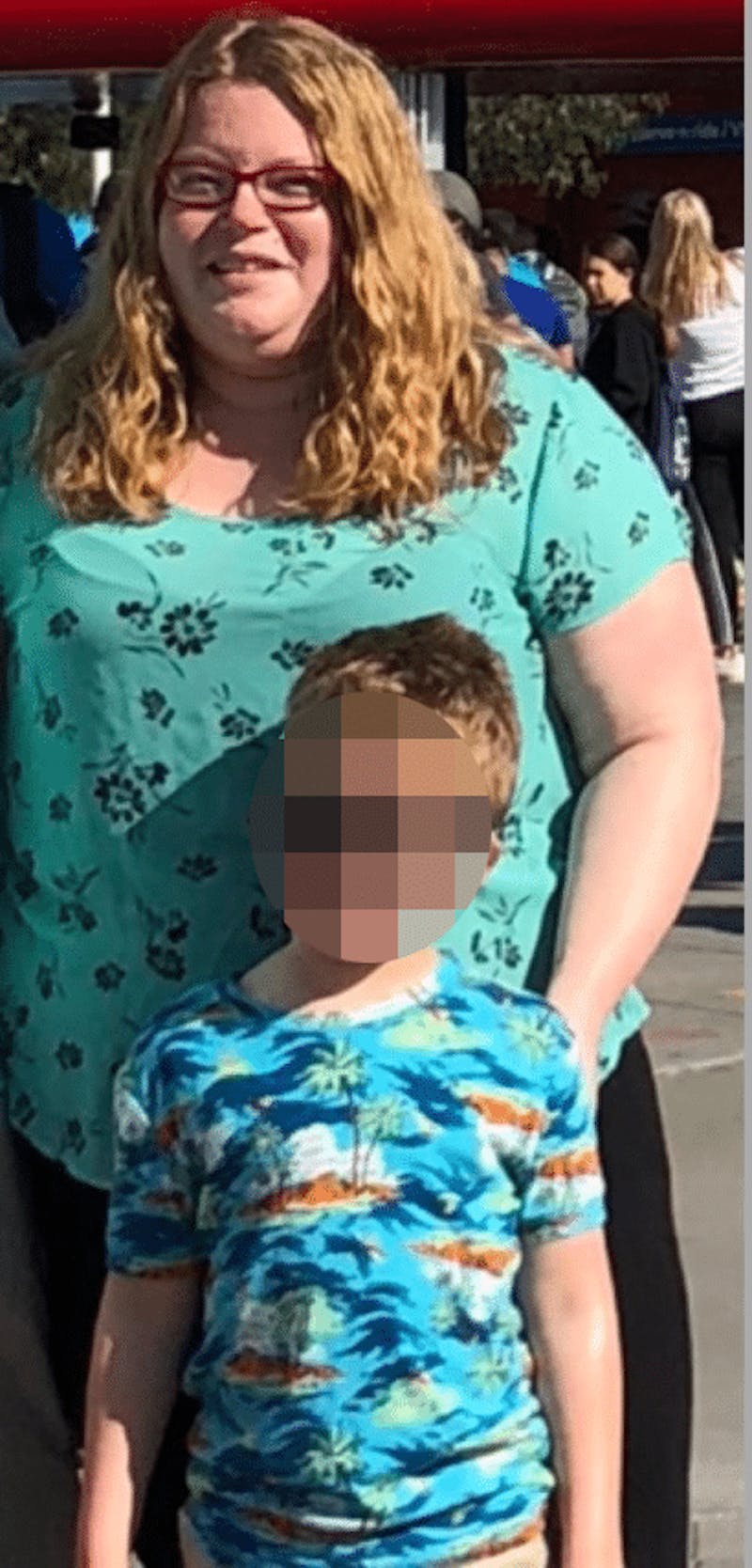 Patients 20-39 Years Old Before & After Gallery - Patient 14494152 - Image 1