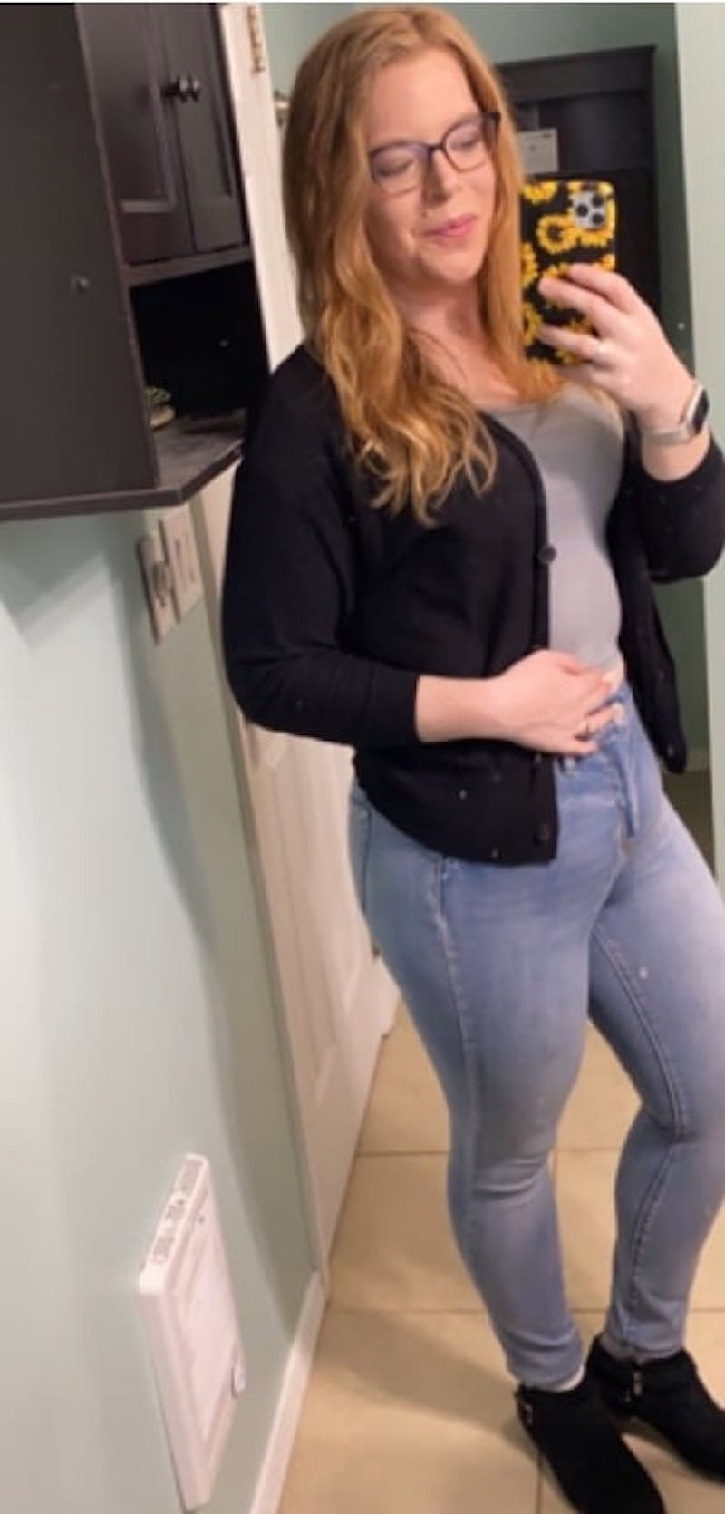 Patients 20-39 Years Old Before & After Gallery - Patient 14494152 - Image 2