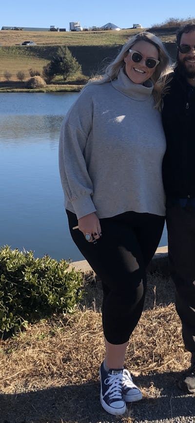 Patients 20-39 Years Old Before & After Gallery - Patient 14494154 - Image 1