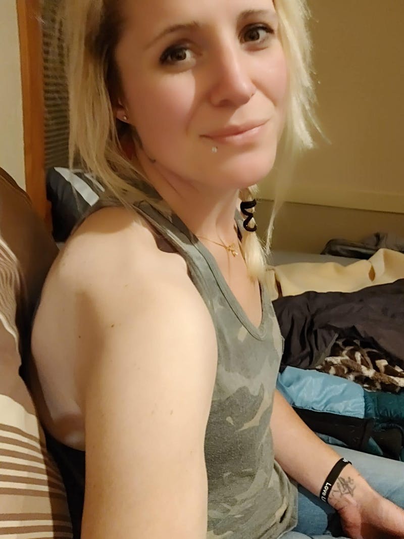 Patients 20-39 Years Old Before & After Gallery - Patient 14494155 - Image 2