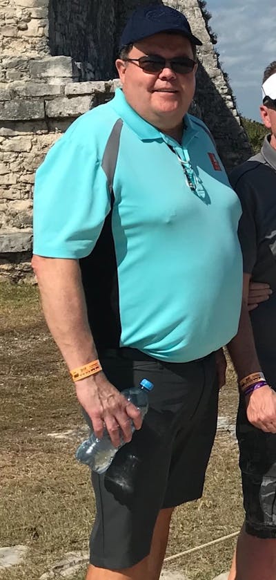 Patients 40-59 Years Old Before & After Gallery - Patient 14494156 - Image 1