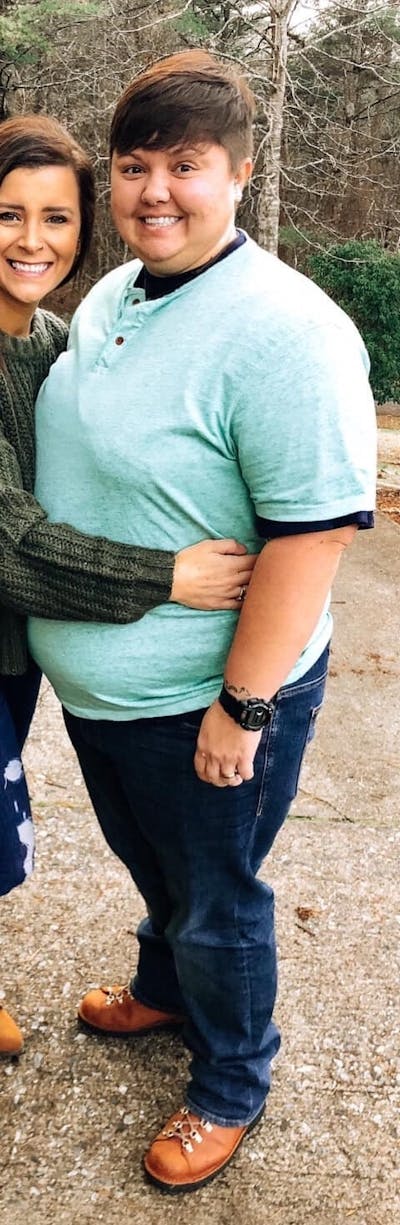 Patients 20-39 Years Old Before & After Gallery - Patient 14494157 - Image 1