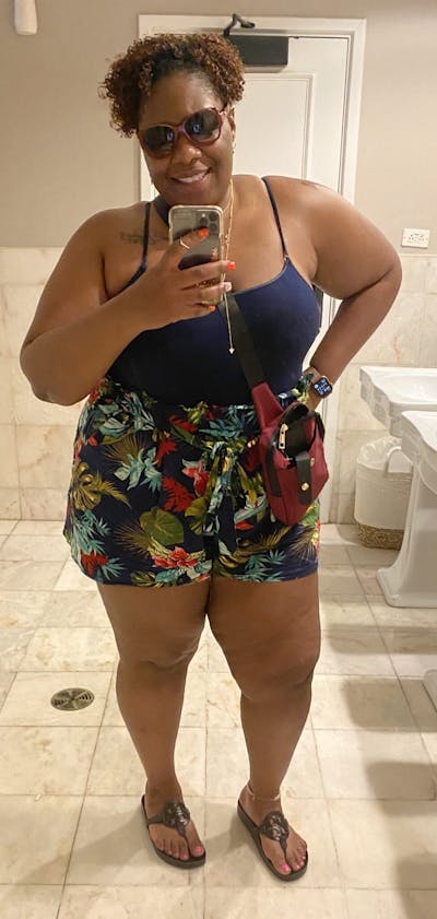 Patients 20-39 Years Old Before & After Gallery - Patient 14494159 - Image 1