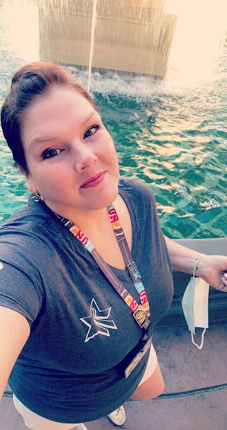 Patients 20-39 Years Old Before & After Gallery - Patient 14494162 - Image 2