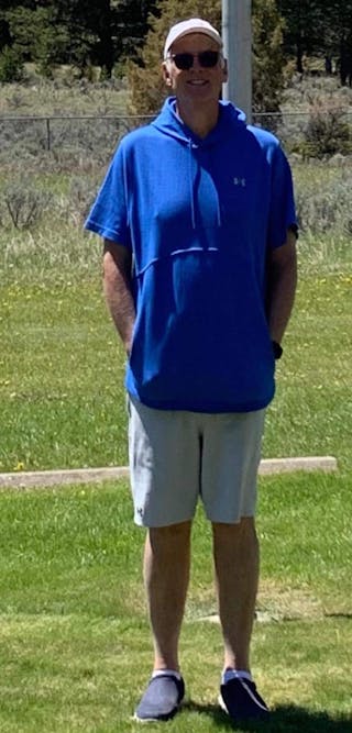 Patients 60-88 Years Old Before & After Gallery - Patient 14494161 - Image 2