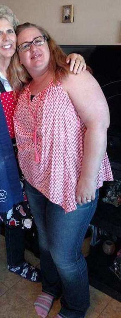 Patients 40-59 Years Old Before & After Gallery - Patient 14494163 - Image 1