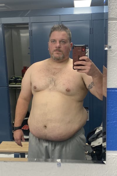 Patients 40-59 Years Old Before & After Gallery - Patient 14494167 - Image 1