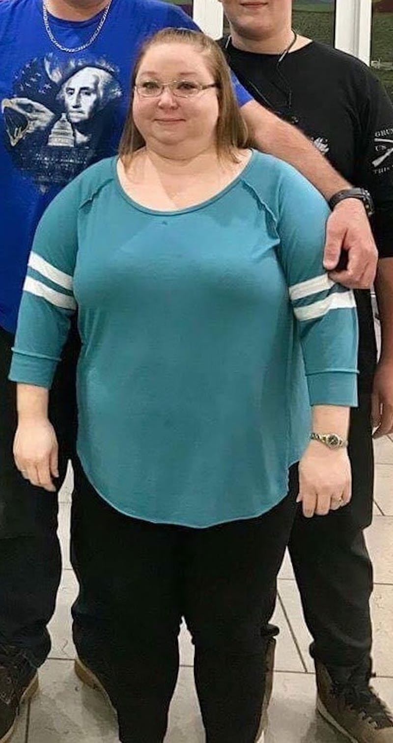 Patients 20-39 Years Old Before & After Gallery - Patient 14494168 - Image 1