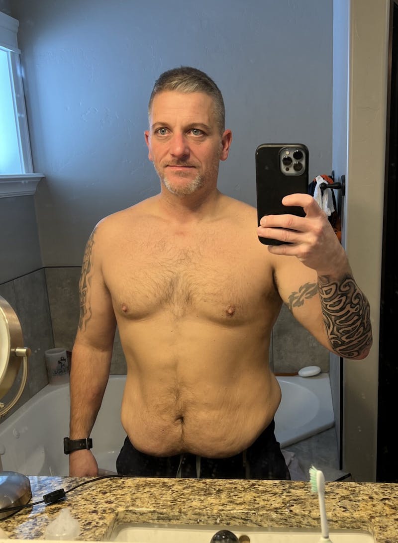 Patients 40-59 Years Old Before & After Gallery - Patient 14494167 - Image 2