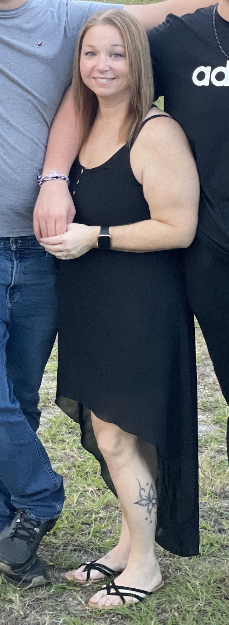 Patients 20-39 Years Old Before & After Gallery - Patient 14494168 - Image 2