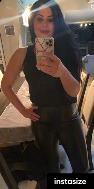 Patients 20-39 Years Old Before & After Gallery - Patient 14494171 - Image 2