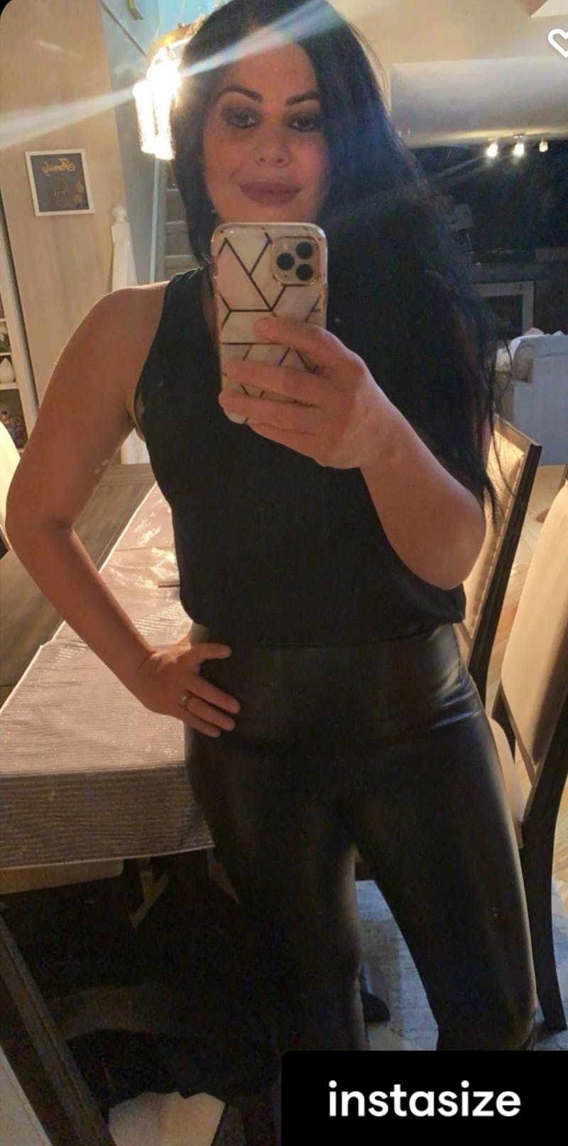 Patients 20-39 Years Old Before & After Gallery - Patient 14494171 - Image 2