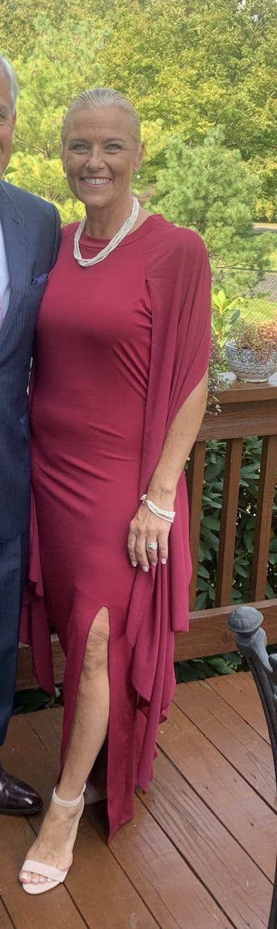 Patients 40-59 Years Old Before & After Gallery - Patient 14494173 - Image 1