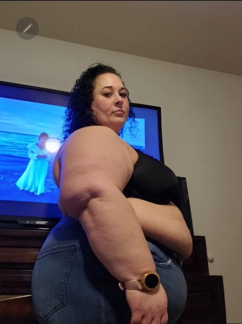 Patients 20-39 Years Old Before & After Gallery - Patient 14494177 - Image 1