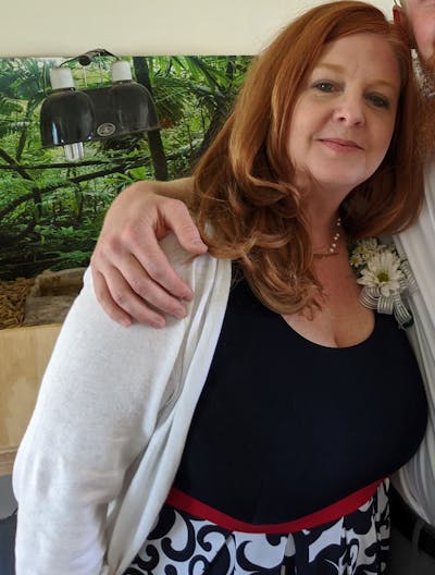 Patients 40-59 Years Old Before & After Gallery - Patient 14494179 - Image 1